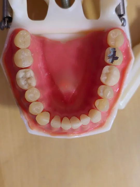 Manequim DENTÍSTICA e PRÓTESE - Foto 4