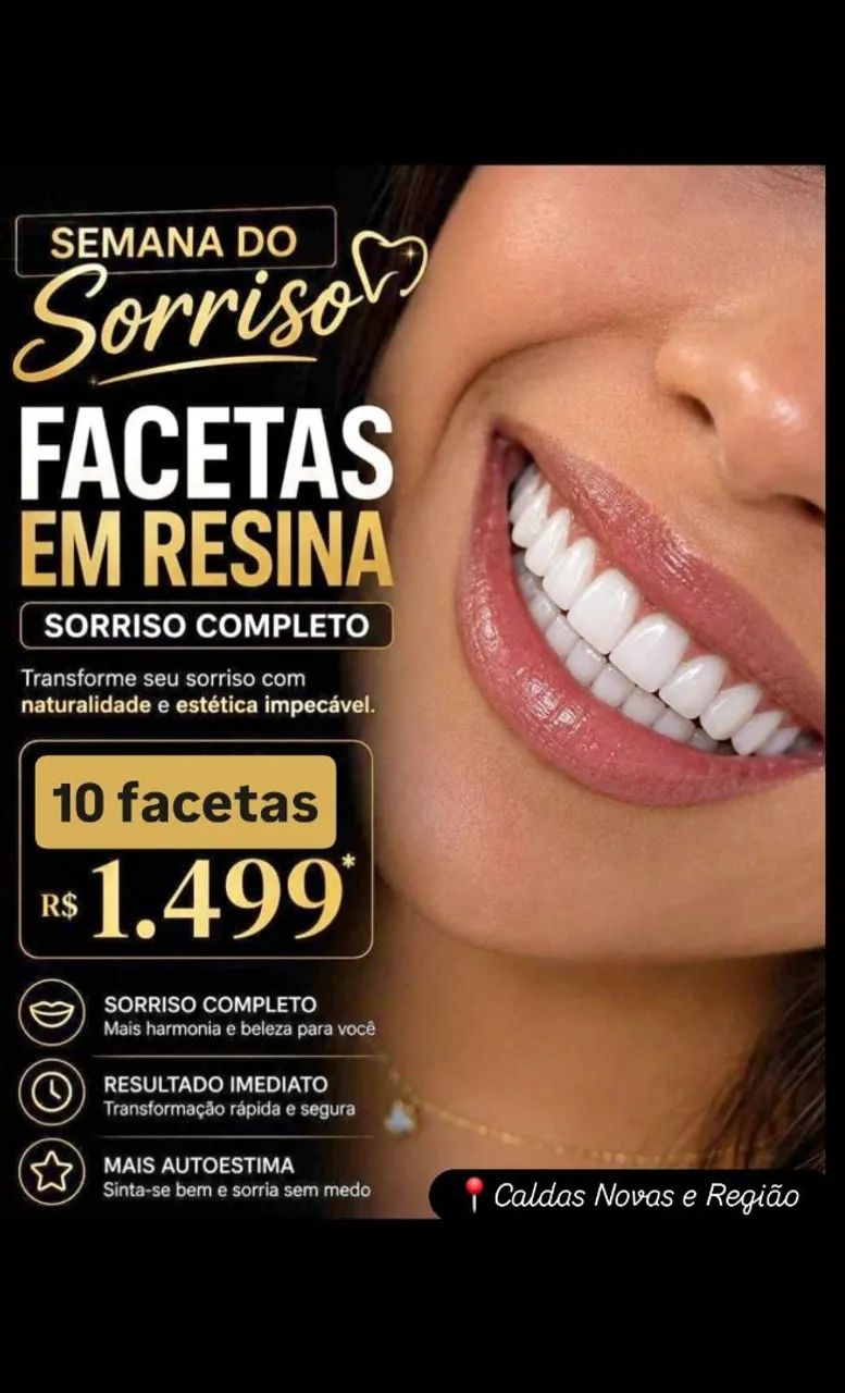 Facetas de resina 