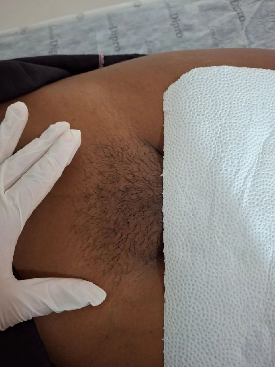 Depilação de cera - Foto 2