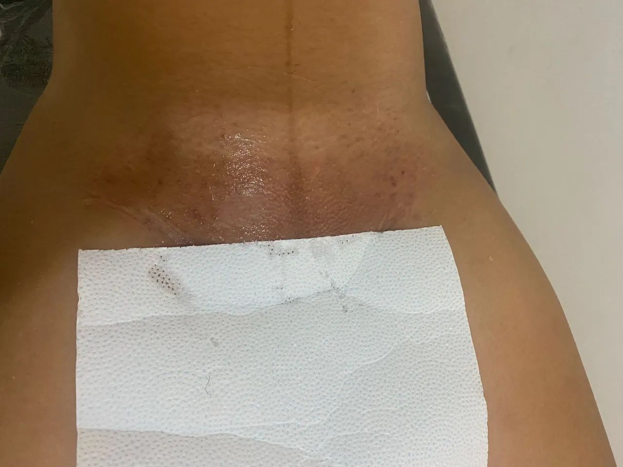 Depilação de cera - Foto 5