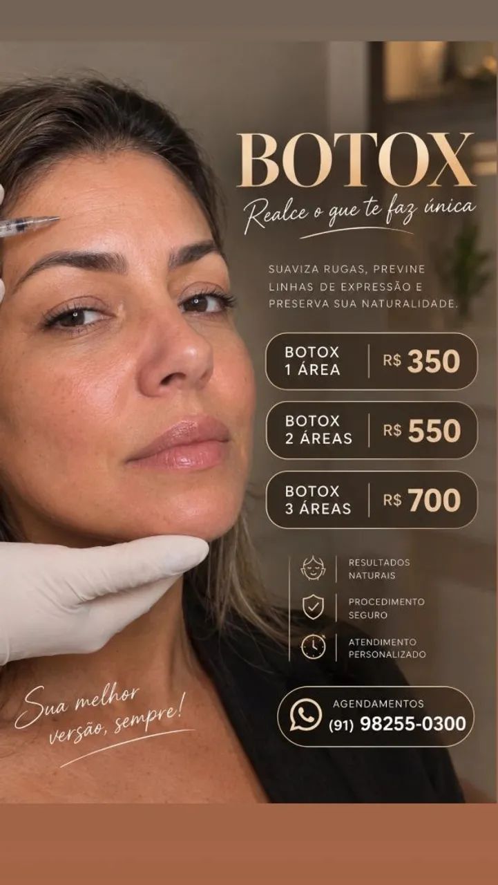 Harmonização facial - Foto 3