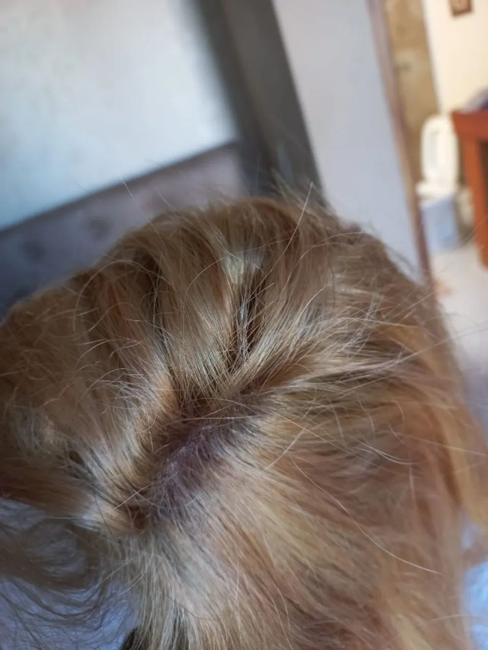 Prótese capilar feminina  - Foto 2