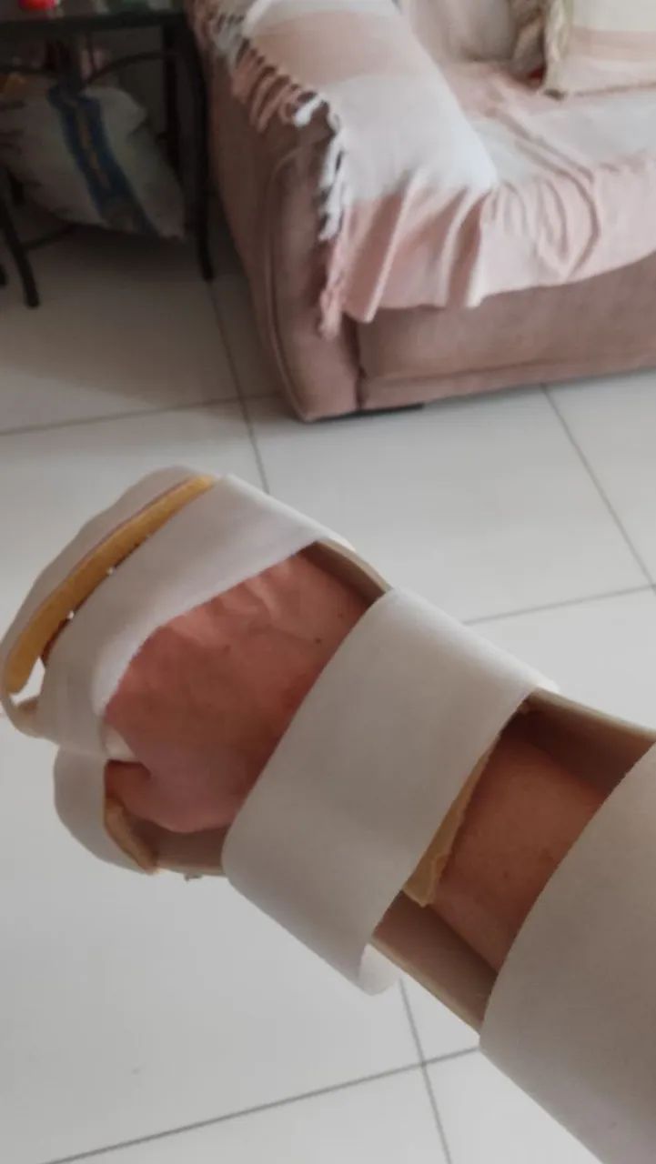 Ortesi para sequela AVC mão direita!!! - Foto 5