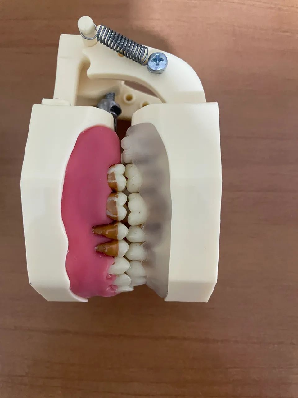 Manequim periodontia orais - Foto 3