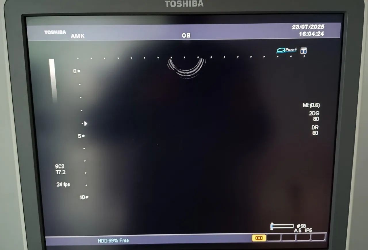 Aparelho de Ultrassom Toshiba SSA 680 A - Foto 3