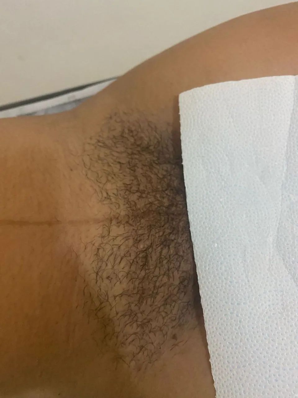 Depilação de cera - Foto 4