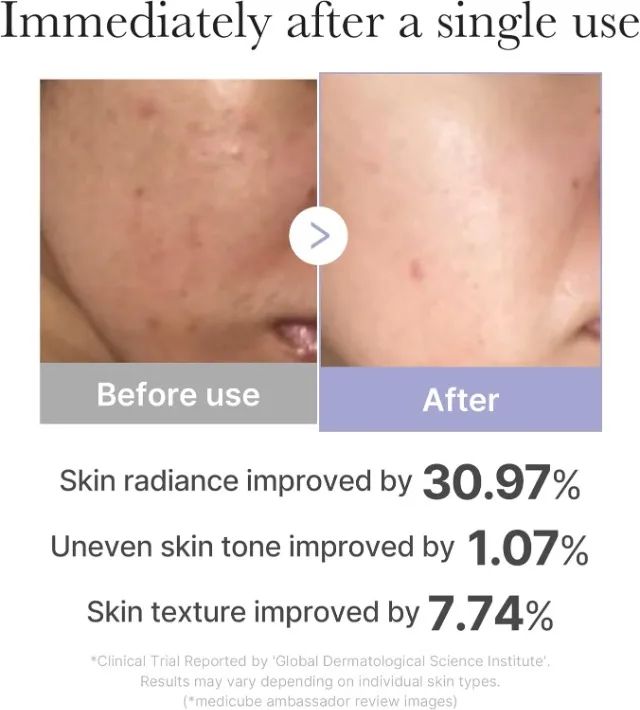 Lacrado - Medicube AGE-R Booster Pro Mini - Skincare K-Beauty - Foto 2