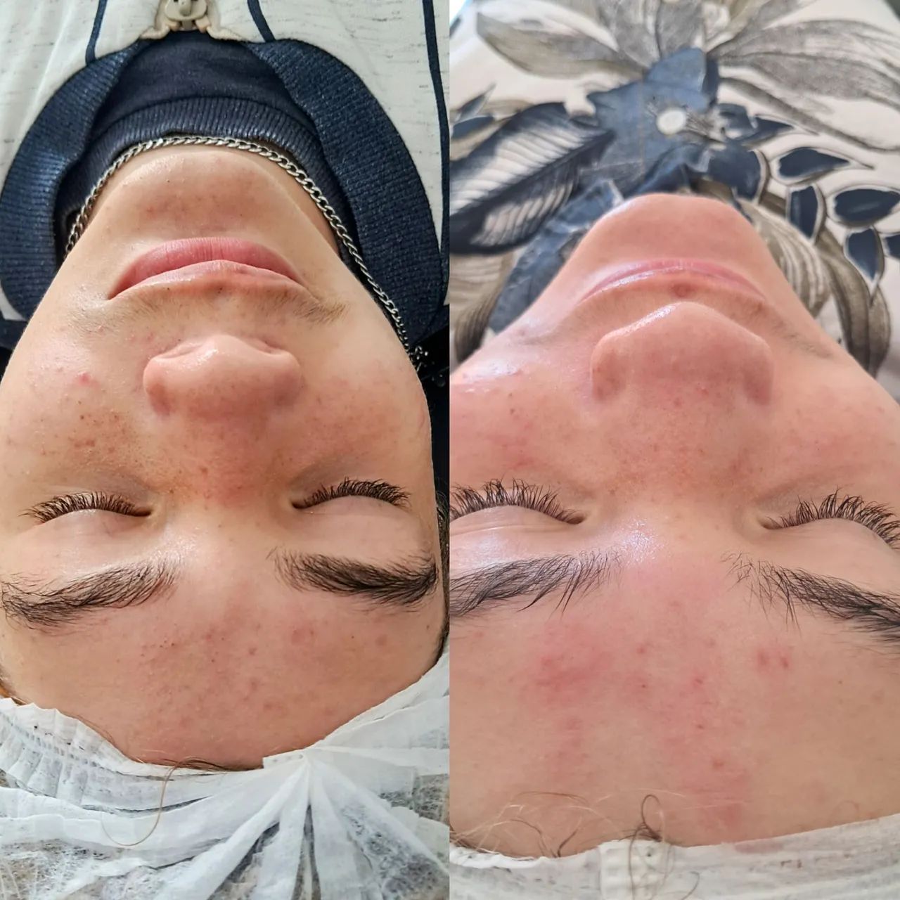 Limpeza de Pele e Extensão de Cílios  - Foto 2