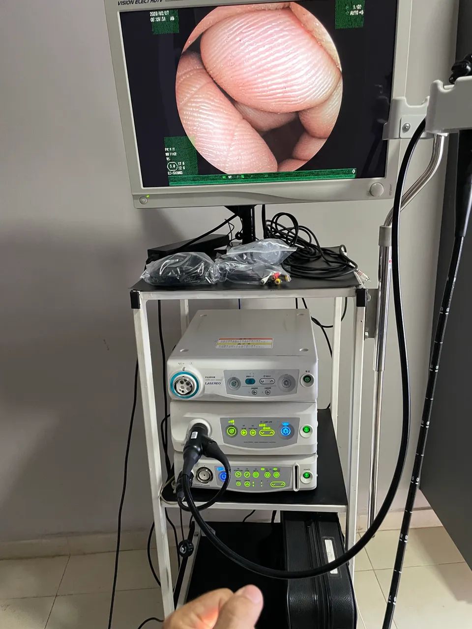 Fujinon 4450 Hd com 2 gastros e 2 colonos