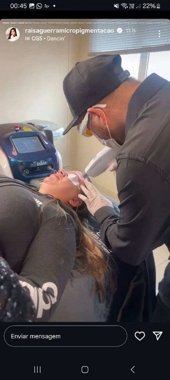 Remoção de tatuagem a lazer - Foto 4