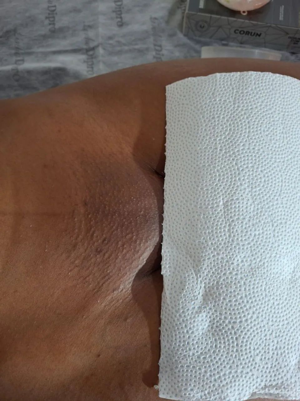 Depilação de cera - Foto 3