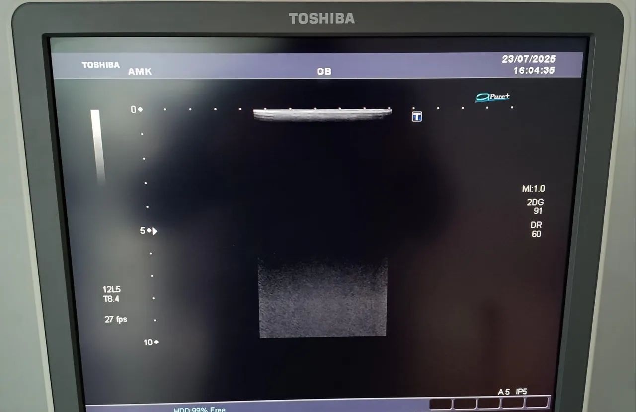 Aparelho de Ultrassom Toshiba SSA 680 A - Foto 5