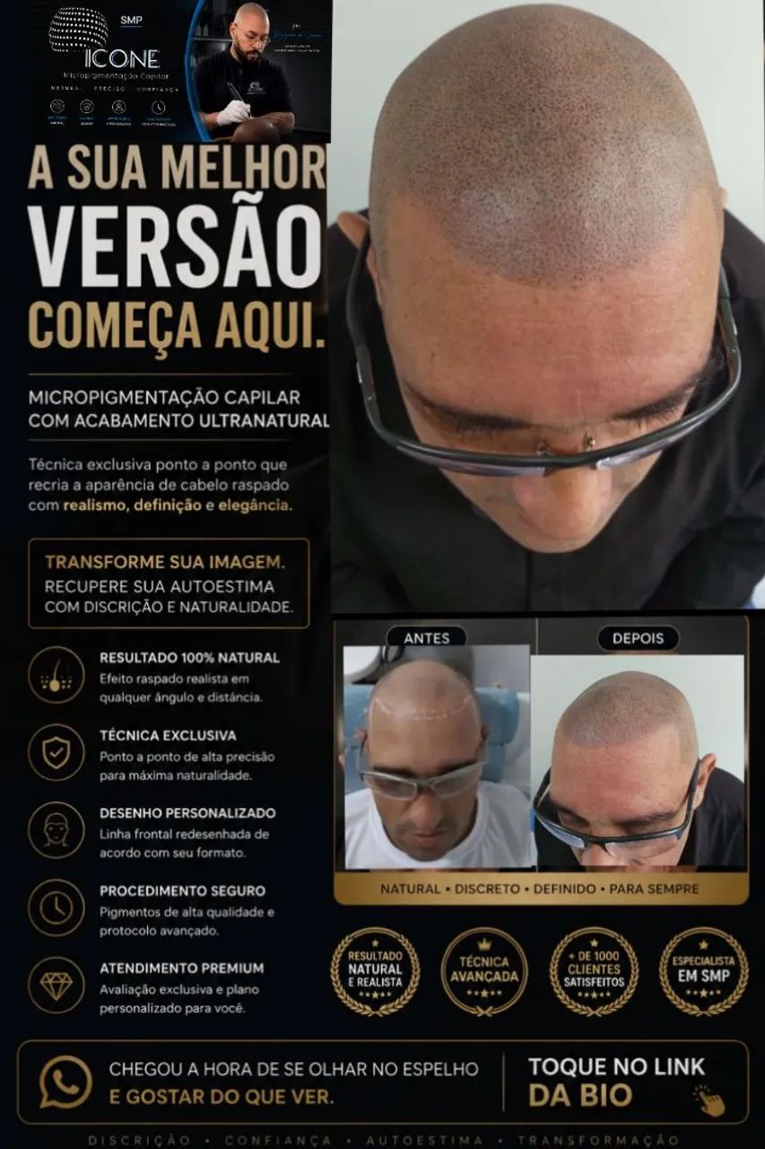 Especialista em Micropigmentação Capilar Masculina - Foto 2