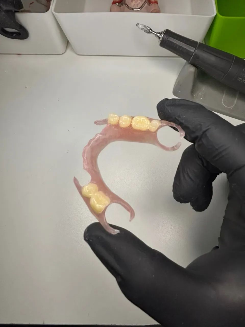 Laboratório de Prótese Dentária - Qualidade, Agilidade e Ótimo Preço! - Foto 2