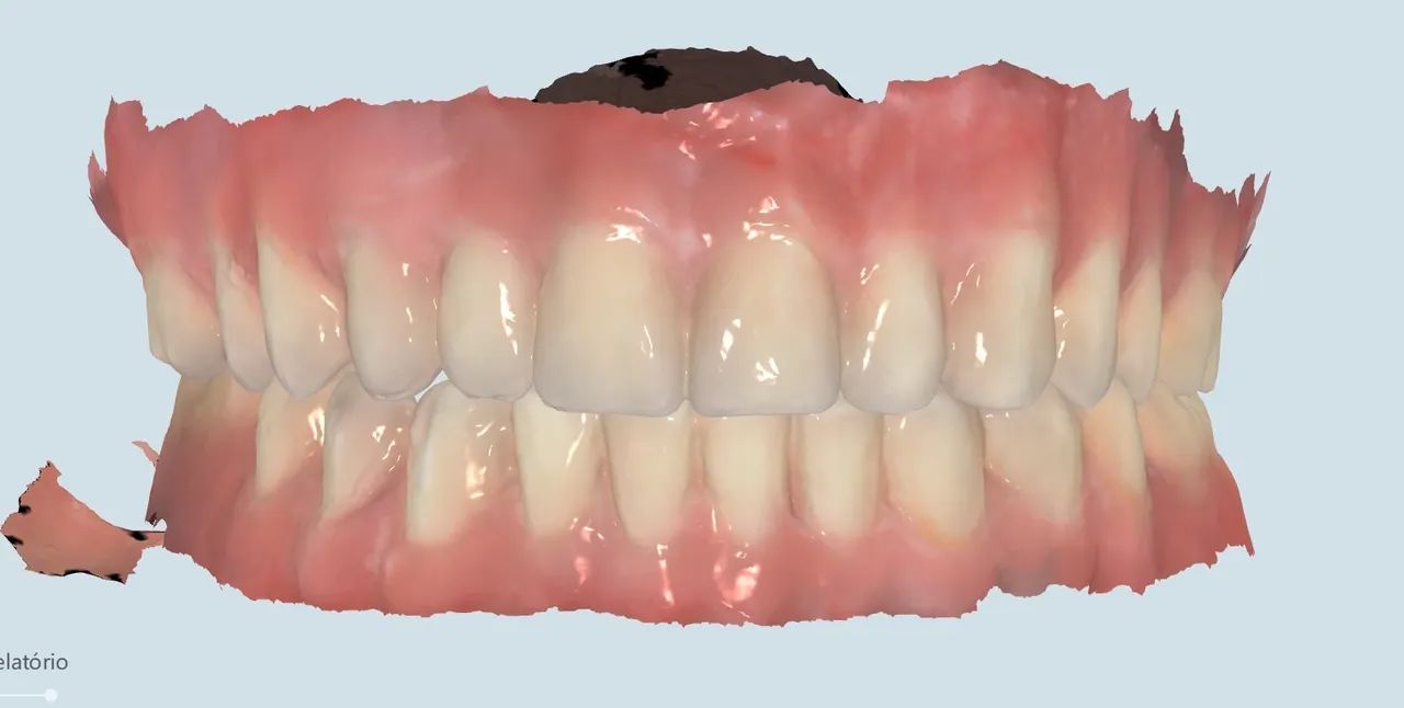 Scanner odontológico 3D  - Foto 3