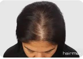 Produto para Cabelo - Foto 5
