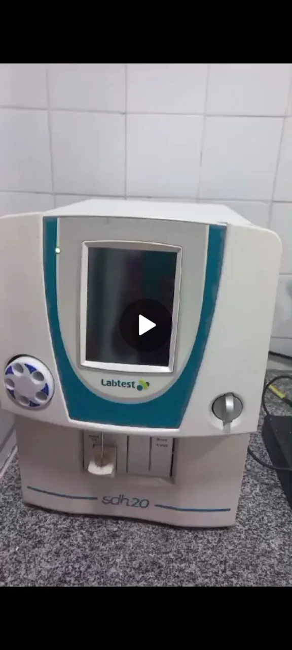 Aparelho de Hemograma Sd 20 labtest. Valor: R$ 10.000