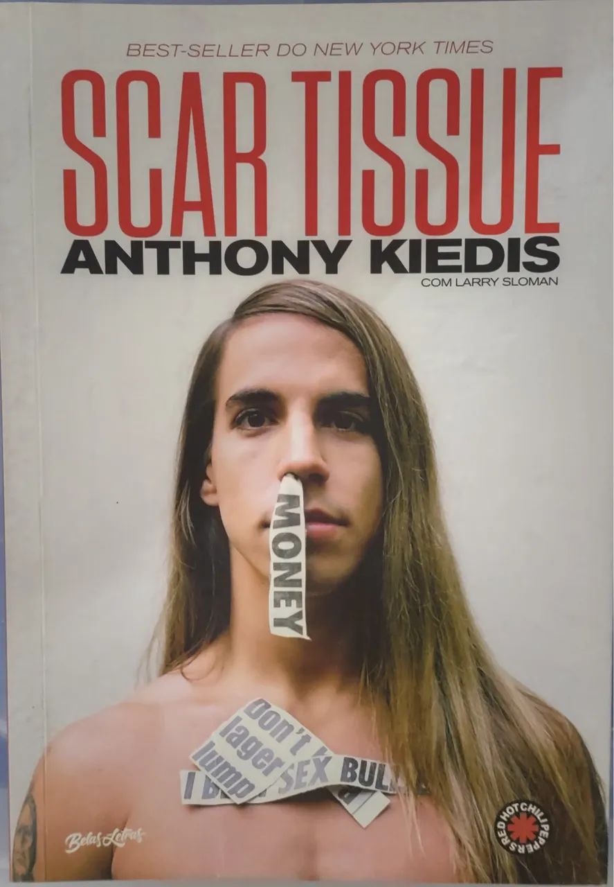 Scar Tissue, Antonhy Kiedes