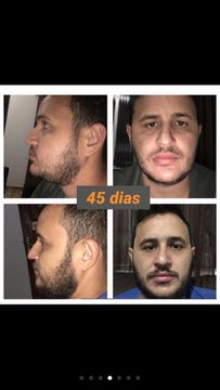 Tonico crescimento capilar barba e sobrancelha 