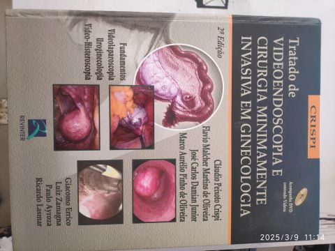 Tratado de Videoendoscopia e Cirurgia Minimamente Invasiva em Ginecologia - 2ª Edição