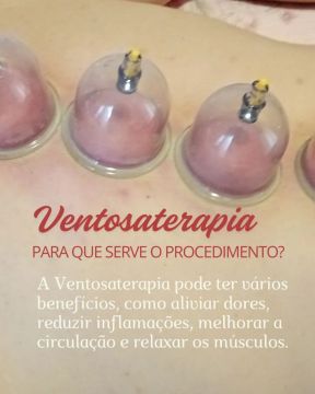 Ventosaterapia 