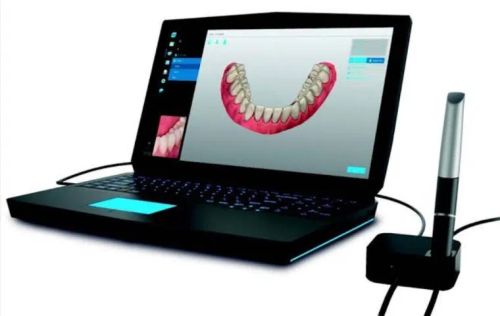 Scanner Odontológico 