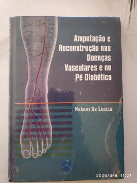 Amputação e Reconstrução nas Doenças Vasculares e no Pé Diabético