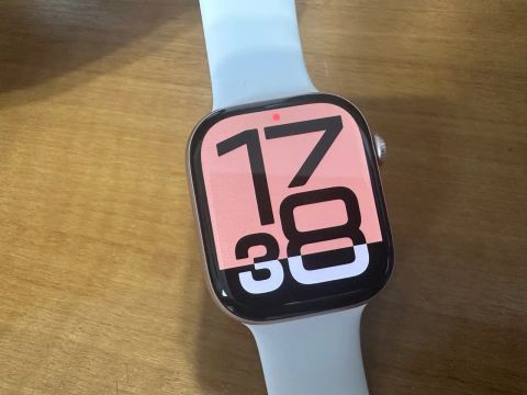 Apple Watch Series 10 Gold Rose 46mm GPS