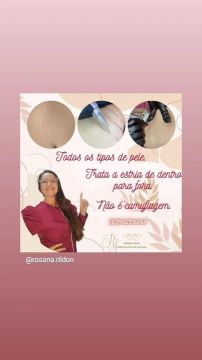 Tratamento estrias 