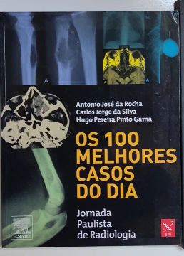 Os 100 melhores casos do dia
