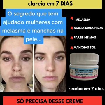 Clareador de manchas (Pague só na entrega)