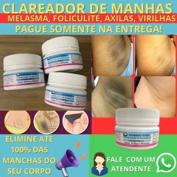 ?PAGUE NA ENTREGA Clareador de Manchas de pele