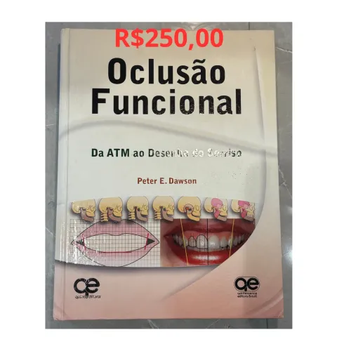 Livro oclusão funcional Okeson- odontologia