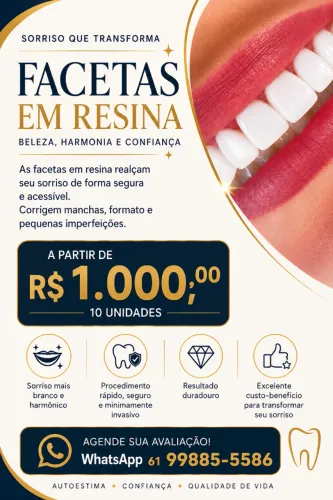 FACETAS EM RESINA