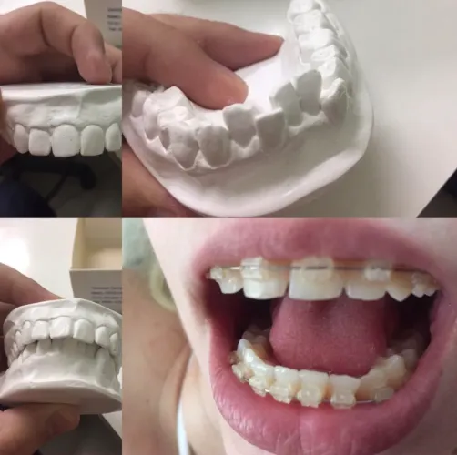 Vaga para dentista clínico 