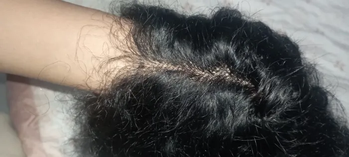 Peruca Lace frontal Cabelo Humano Natural 40 CM