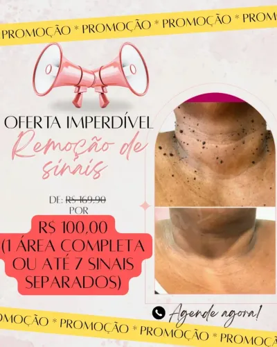 Remoção de sinais