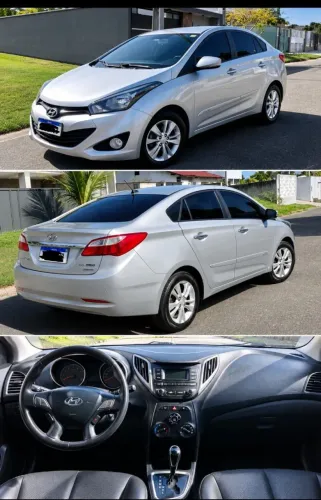 Hyundai HB20S Premium 1.6 Flex 16V Aut. 4P 2015