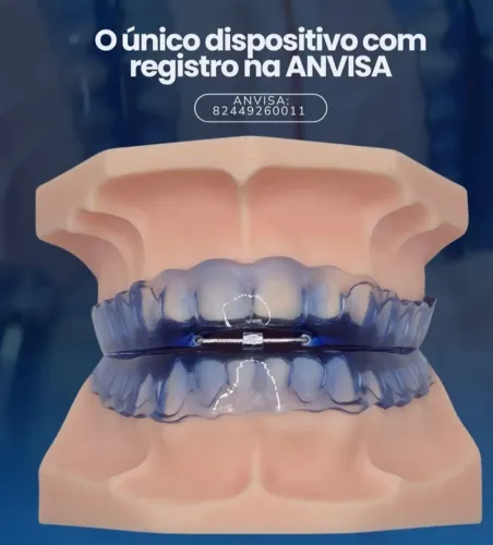 Aparelho Anti Ronco e Apnéia