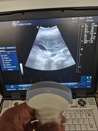 Ultrassom portátil Lógic E