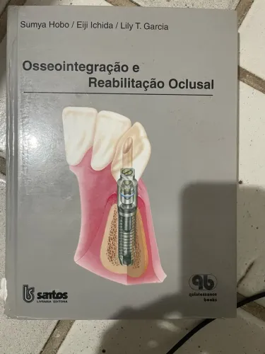 Livro de odontologia prótese sobre implantes