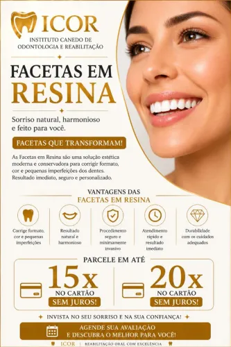 Facetas em Resina 