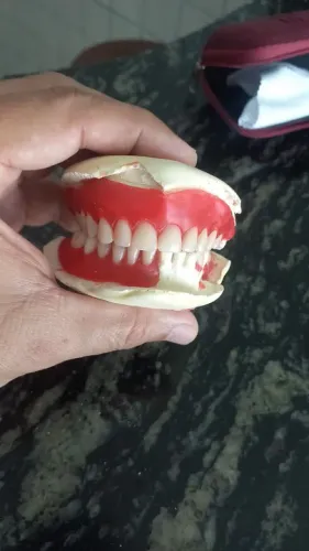 Dentadura preço mole