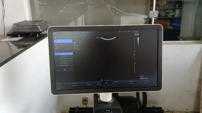 Aparelho Ultrassonografia Samsung hs30 semi-novo