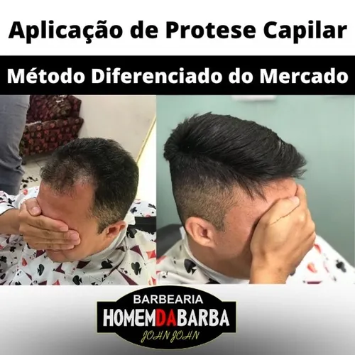 Prótese Capilar São Luís
