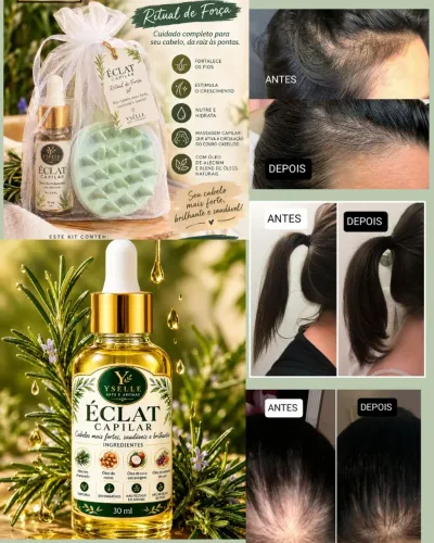 Kit Éclat capilar ( óleo fortalecedor capilar de alecrim30 ml + escova massageadora