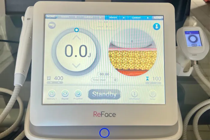 ULTRASSOM REFACE MICROFOCADO E MACROFOCADO (15.000 CADA!!!)