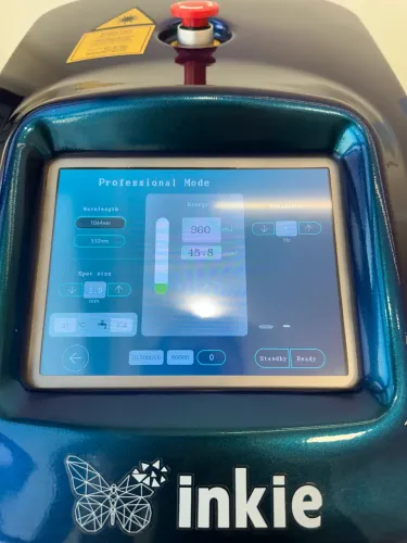 Laser Inkie - Remoção de Tatuagem