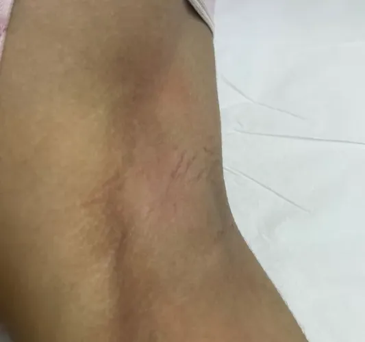 Epilação com cera morna ?