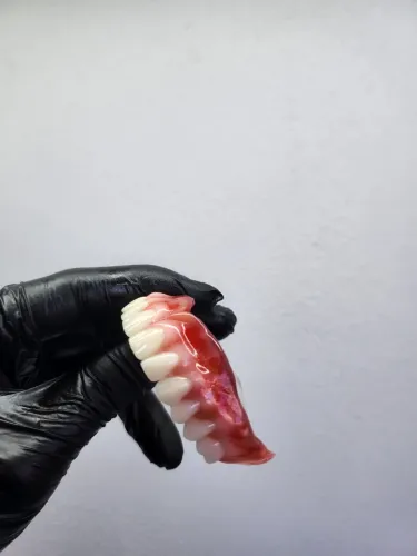 Concertos de dentaduras em menos de 24 horas !